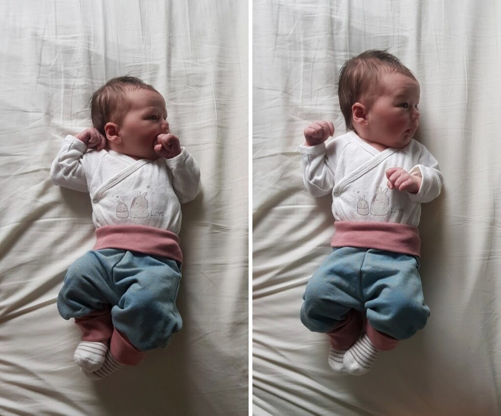To bilder ved siden av hverandre; på begge er det en baby som ligger på et hvitt laken, fotografert ovenfra og ned. 
